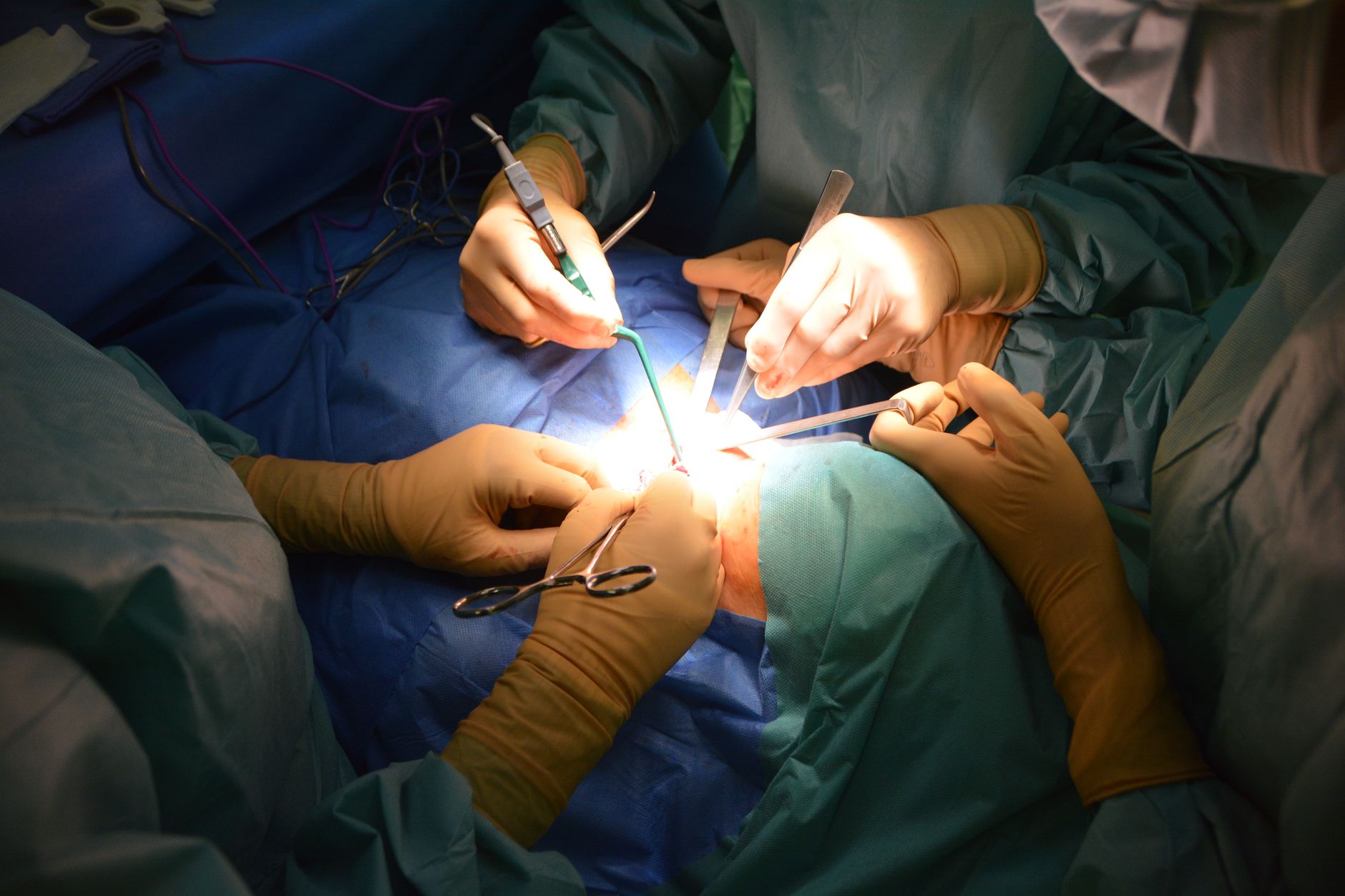 Close-up view of surgeons in an operating room performing a
